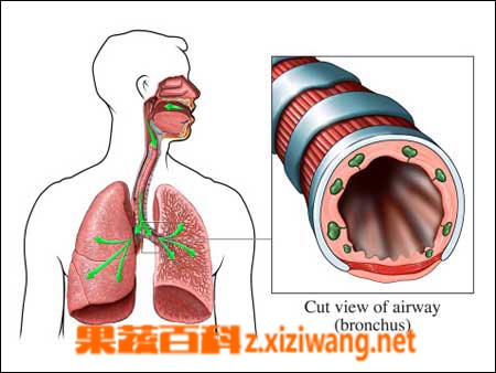 果蔬百科支气管炎